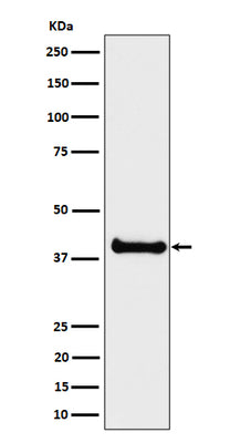 Anti-ALS2CR1 Rabbit Monoclonal Antibody Boster Bio