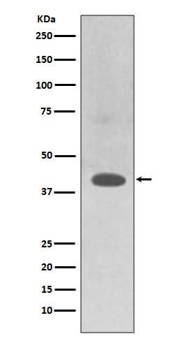 Anti-TRAM2 Rabbit Monoclonal Antibody Boster Bio
