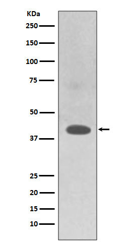 Anti-TRAM2 Rabbit Monoclonal Antibody Boster Bio