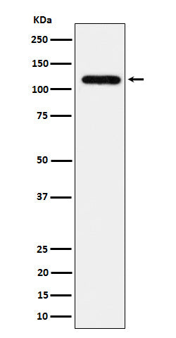 Anti-UBE4A Rabbit Monoclonal Antibody Boster Bio