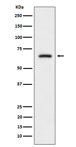 Anti-CRMP3 Rabbit Monoclonal Antibody Boster Bio