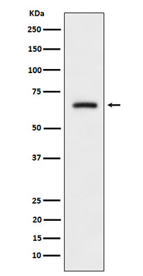 Anti-CRMP3 Rabbit Monoclonal Antibody Boster Bio