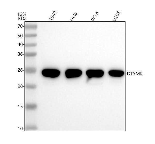 Anti-DTYMK Rabbit Monoclonal Antibody Boster Bio
