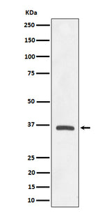 Anti-OXGR1 / GPR99 Rabbit Monoclonal Antibody Boster Bio