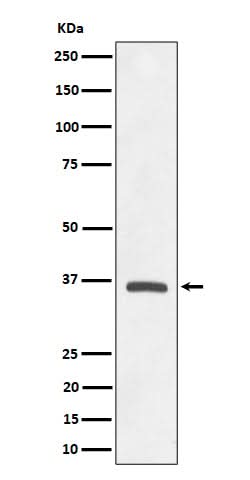 Anti-OXGR1 / GPR99 Rabbit Monoclonal Antibody Boster Bio