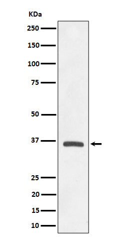 Anti-OXGR1 / GPR99 Rabbit Monoclonal Antibody Boster Bio