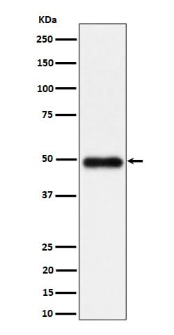 Anti-NgR3 Rabbit Monoclonal Antibody Boster Bio