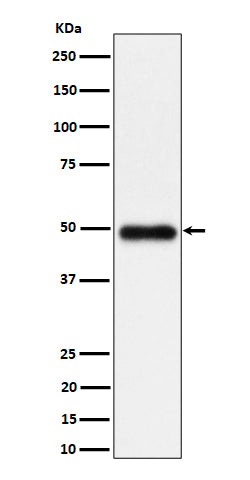 Anti-NgR3 Rabbit Monoclonal Antibody Boster Bio