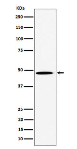 Anti-HIF Prolyl Hydroxylases Rabbit Monoclonal Antibody Boster Bio