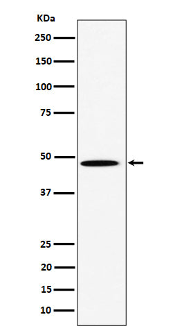 Anti-HIF Prolyl Hydroxylases Rabbit Monoclonal Antibody Boster Bio