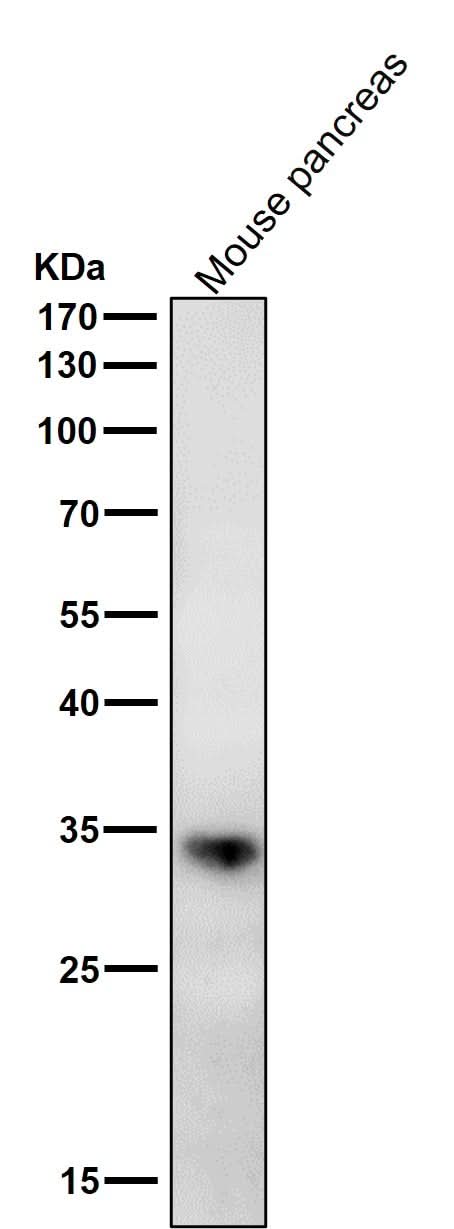 Anti-ERP27 Rabbit Monoclonal Antibody Boster Bio