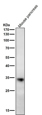 Anti-ERP27 Rabbit Monoclonal Antibody Boster Bio