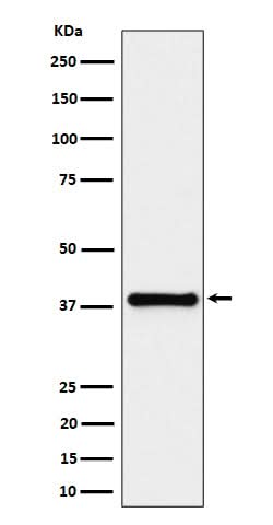 Anti-UCHL5IP Rabbit Monoclonal Antibody Boster Bio