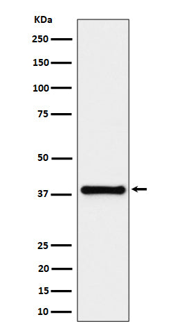 Anti-UCHL5IP Rabbit Monoclonal Antibody Boster Bio