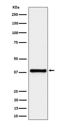 Anti-UCHL5IP Rabbit Monoclonal Antibody Boster Bio