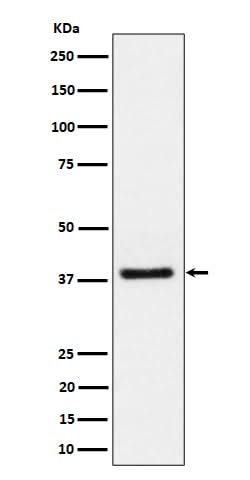 Anti-UCHL5IP Rabbit Monoclonal Antibody Boster Bio
