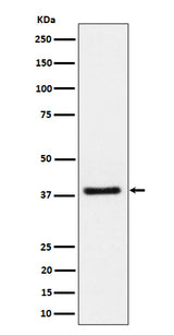 Anti-UCHL5IP Rabbit Monoclonal Antibody Boster Bio