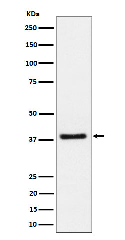 Anti-UCHL5IP Rabbit Monoclonal Antibody Boster Bio