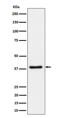 Anti-UCHL5IP Rabbit Monoclonal Antibody Boster Bio