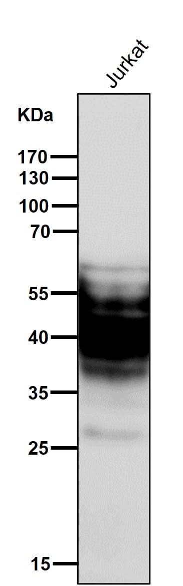 Anti-SYPL1 Rabbit Monoclonal Antibody Boster Bio