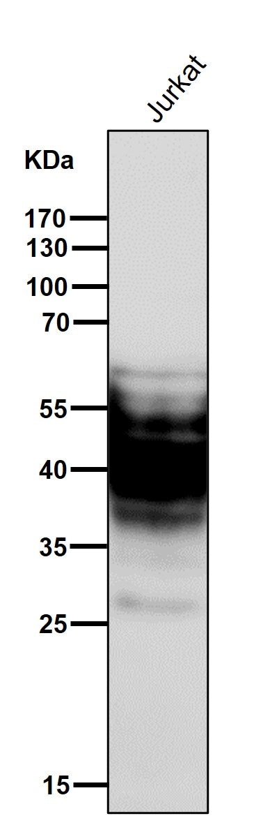 Anti-SYPL1 Rabbit Monoclonal Antibody Boster Bio