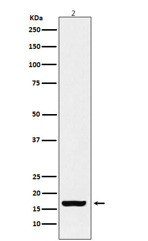 Anti-Histone H3 (acetyl K18) Rabbit Monoclonal Antibody Boster Bio