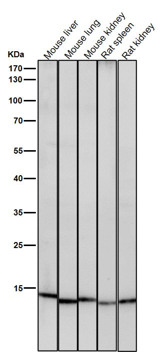 Anti-Histone H3 (acetyl K23) Rabbit Monoclonal Antibody Boster Bio