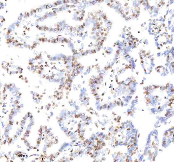 Anti-Histone H3 (acetyl K9) Rabbit Monoclonal Antibody Boster Bio