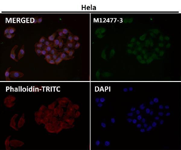 Anti-Histone H3 (mono methyl R2) HIST1H3A Rabbit Monoclonal Antibody Boster Bio