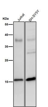Anti-Phospho-Histone H3 (S28) Rabbit Monoclonal Antibody Boster Bio
