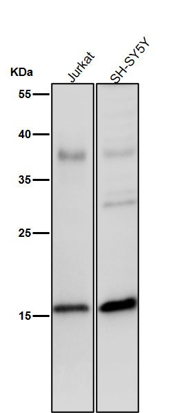 Anti-Phospho-Histone H3 (S28) Rabbit Monoclonal Antibody Boster Bio