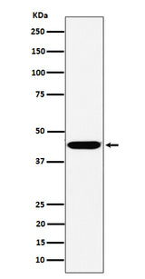 Anti-KCTD9 Rabbit Monoclonal Antibody Boster Bio