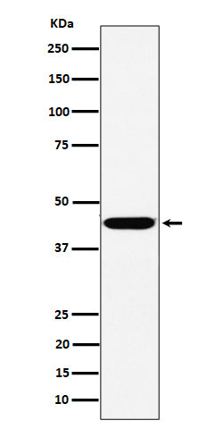 Anti-KCTD9 Rabbit Monoclonal Antibody Boster Bio