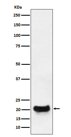 Anti-DCTN5 Rabbit Monoclonal Antibody Boster Bio