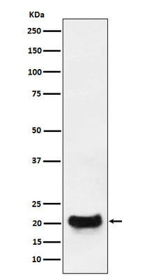 Anti-DCTN5 Rabbit Monoclonal Antibody Boster Bio