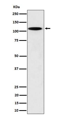 Anti-N4BP1 Rabbit Monoclonal Antibody Boster Bio
