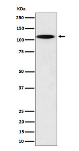 Anti-N4BP1 Rabbit Monoclonal Antibody Boster Bio