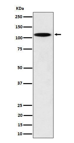 Anti-N4BP1 Rabbit Monoclonal Antibody Boster Bio