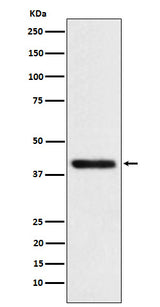 Anti-TMOD2 Rabbit Monoclonal Antibody Boster Bio