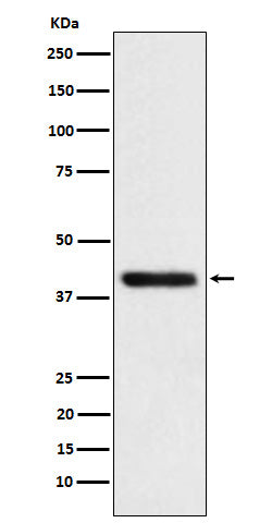 Anti-TMOD2 Rabbit Monoclonal Antibody Boster Bio