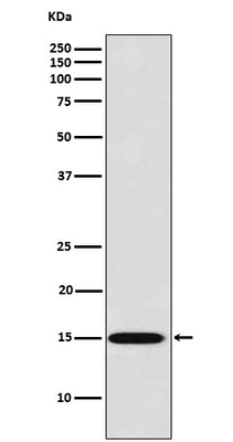 Anti-Galectin 7 Rabbit Monoclonal Antibody Boster Bio