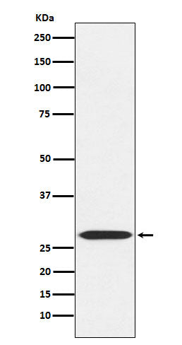Anti-MRPL28 Rabbit Monoclonal Antibody Boster Bio