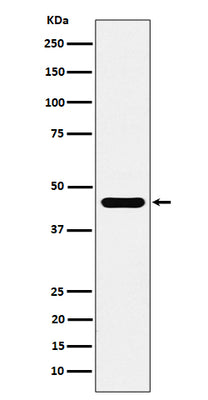 Anti-ACTR1B Rabbit Monoclonal Antibody Boster Bio
