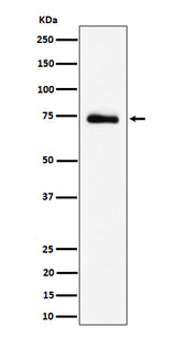 Anti-RAVER2 Rabbit Monoclonal Antibody Boster Bio