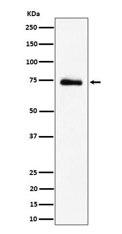Anti-RAVER2 Rabbit Monoclonal Antibody Boster Bio