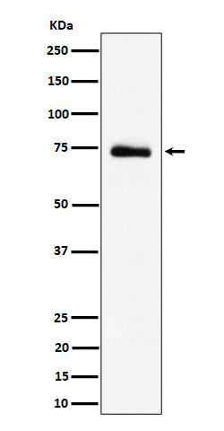 Anti-RAVER2 Rabbit Monoclonal Antibody Boster Bio
