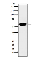Anti-Salivary alpha amylase Rabbit Monoclonal Antibody Boster Bio