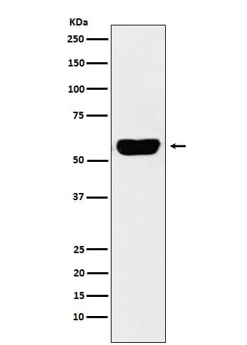 Anti-Salivary alpha amylase Rabbit Monoclonal Antibody Boster Bio