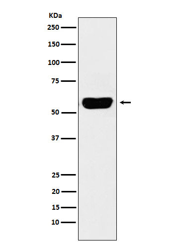 Anti-Salivary alpha amylase Rabbit Monoclonal Antibody Boster Bio