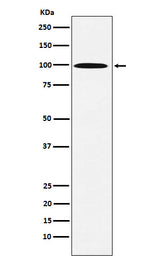 Anti-AP1G1 Rabbit Monoclonal Antibody Boster Bio